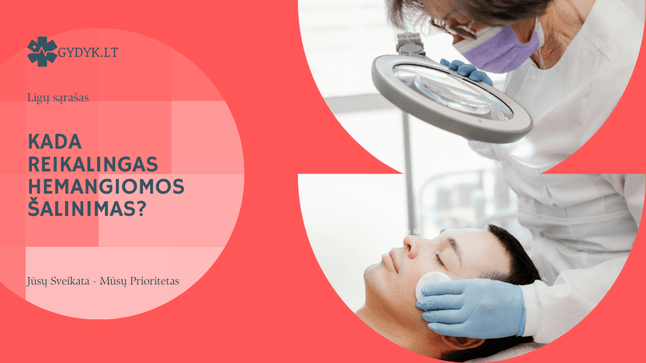 Kada reikalingas hemangiomos šalinimas? Chirurginio ir nechirurginio gydymo galimybės