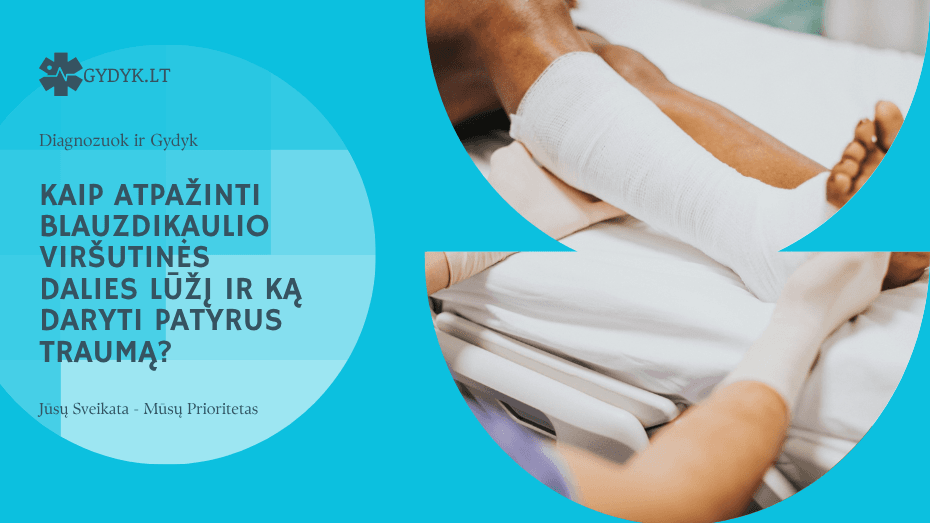 Kaip atpažinti blauzdikaulio viršutinės dalies lūžį ir ką daryti patyrus traumą?