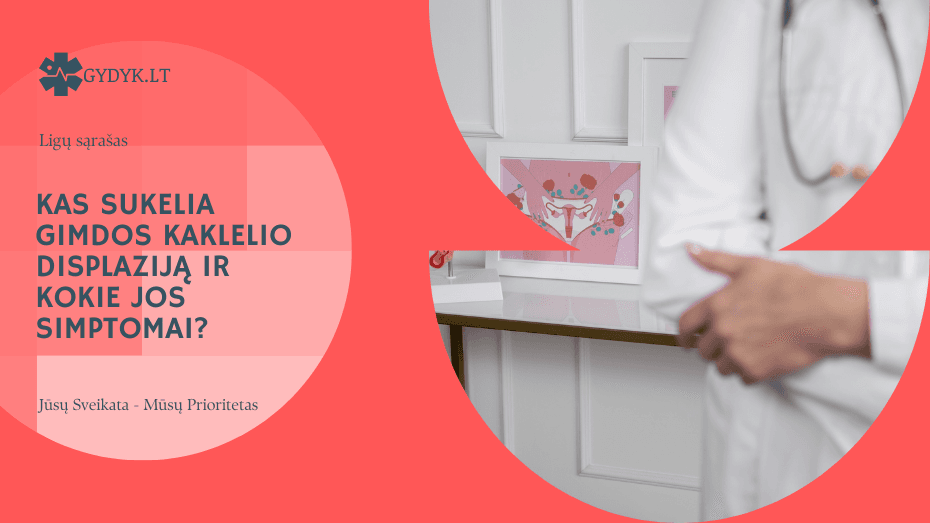 Kas sukelia gimdos kaklelio displaziją ir kokie jos simptomai?