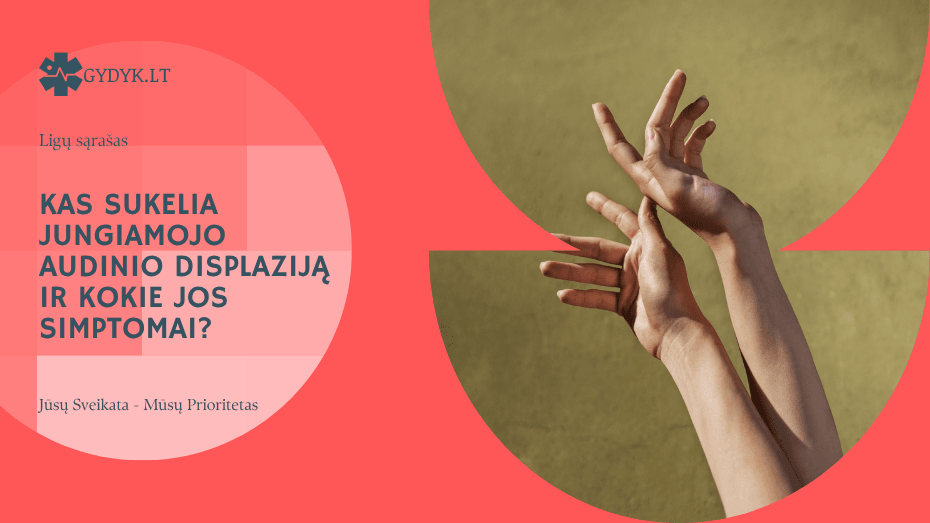 Kas sukelia jungiamojo audinio displaziją ir kokie jos simptomai?