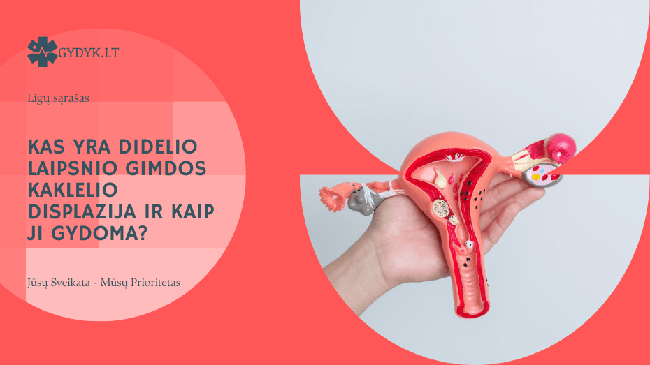 Kas yra didelio laipsnio gimdos kaklelio displazija ir kaip ji gydoma?