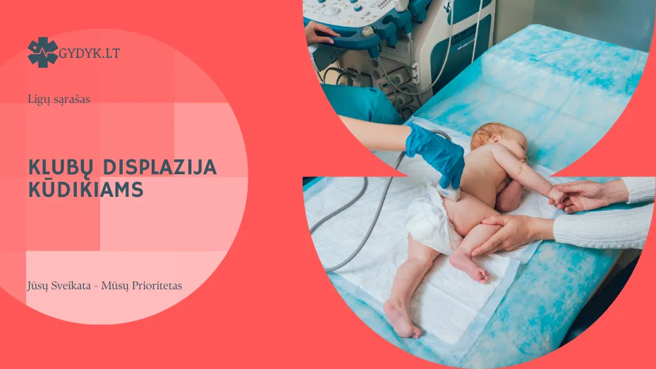 Klubų displazija kūdikiams: priežastys, diagnostika ir gydymas