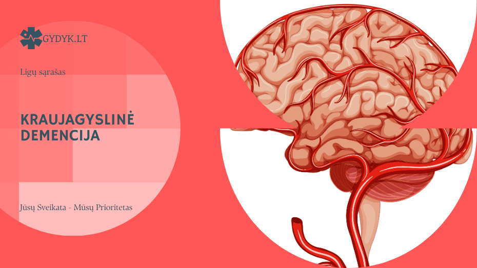 Kraujagyslinė demencija: pagrindiniai simptomai ir ankstyvieji požymiai