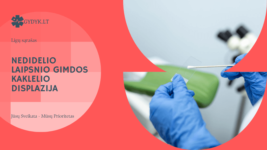 Nedidelio laipsnio gimdos kaklelio displazija: ką reiškia ši diagnozė