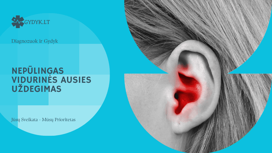 Nepūlingas vidurinės ausies uždegimas: simptomai, gydymas ir kada sunerimti