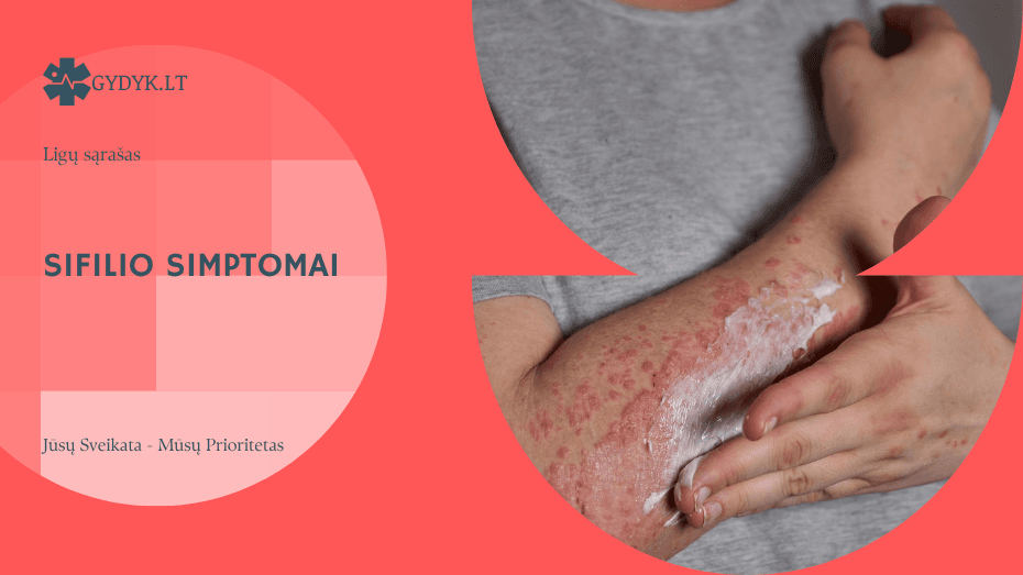 Sifilio simptomai: kaip atpažinti pirmuosius požymius ir kada kreiptis į gydytoją