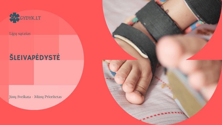 Šleivapėdystė: priežastys, simptomai ir gydymo galimybės