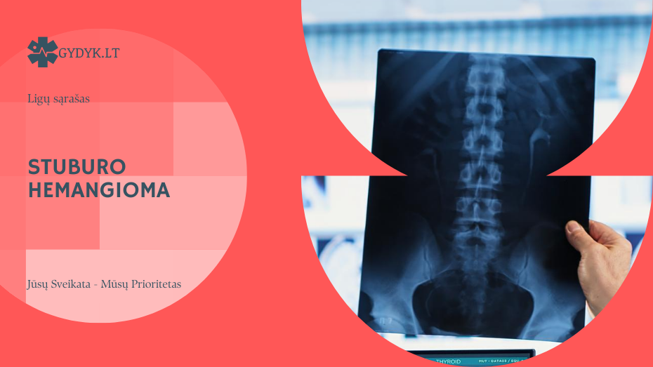 Stuburo hemangioma: simptomai, komplikacijos ir gydymo galimybės