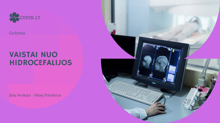 Vaistai nuo hidrocefalijos: kada jie skiriami ir kaip padeda gydyme