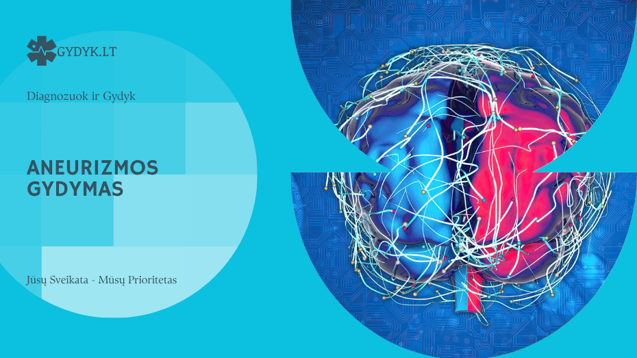 Aneurizmos gydymas: vaistai ir operacija
