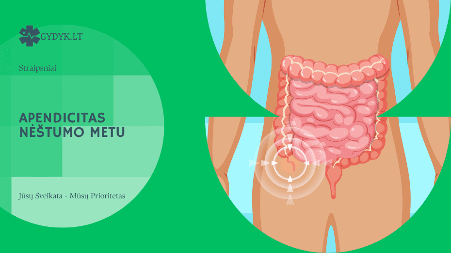 Apendicitas nėštumo metu: simptomai, pavojai ir gydymas