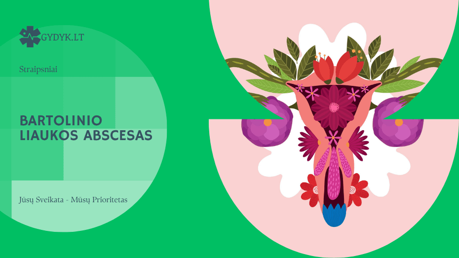 Bartolinio liaukos abscesas: priežastys, simptomai ir gydymas