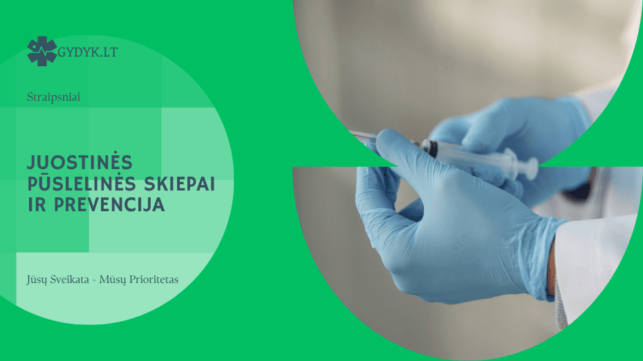 Juostinės pūslelinės skiepai ir prevencija