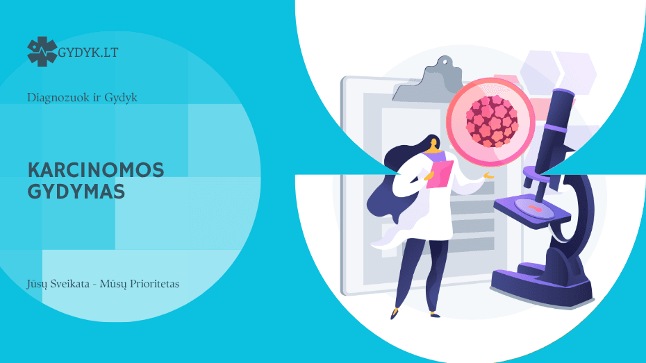 Karcinomos gydymas: kaip gydoma ir nuo ko priklauso
