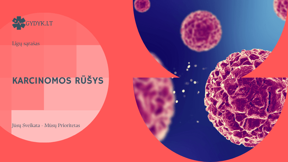 Karcinomos rūšys: papilinė, medulinė ir kiti tipai