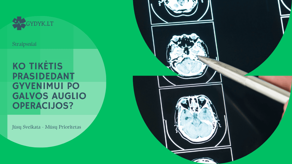 Ko tikėtis prasidedant gyvenimui po galvos auglio operacijos?
