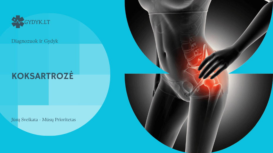 Koksartrozė