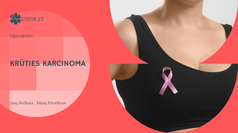 Krūties karcinoma: duktalinė, lobulinė ir invazinės formos