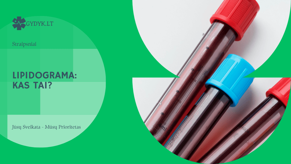 Lipidograma: kas tai? Paprastai ir aiškiai kiekvienam