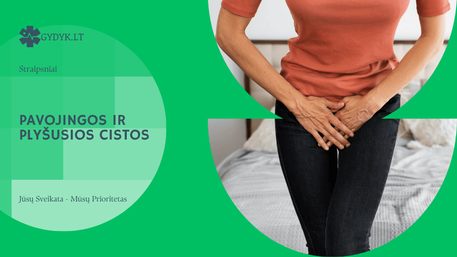 Pavojingos ir plyšusios cistos: simptomai ir komplikacijos