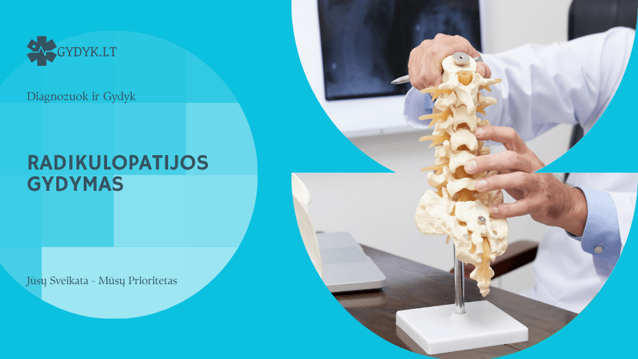 Radikulopatijos gydymas: pratimai ir reabilitacija