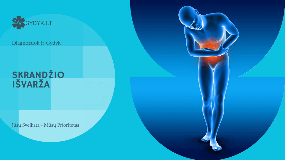 Skrandžio išvarža: simptomai, priežastys ir gydymas