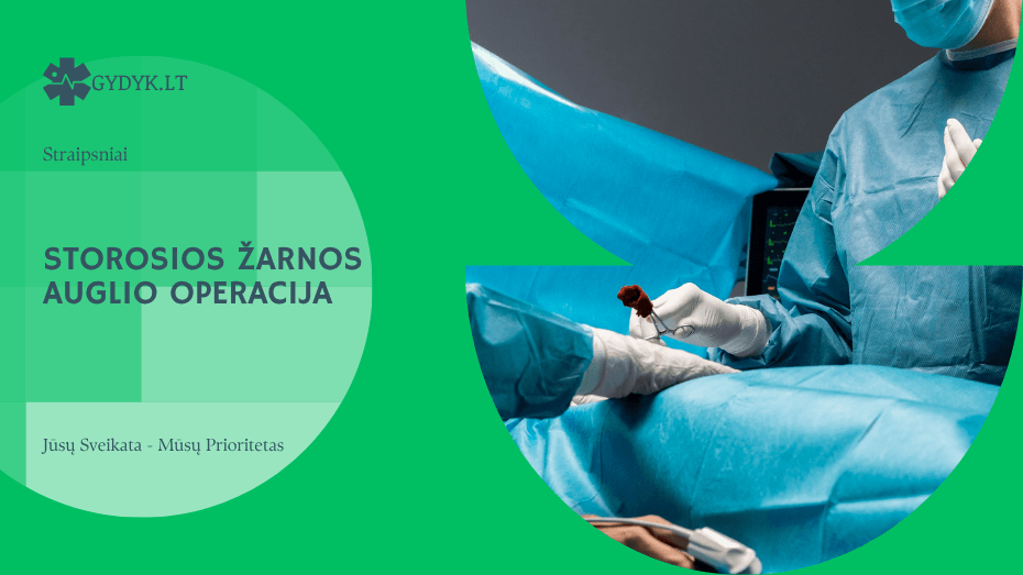 Storosios žarnos auglio operacija: kaip ji atliekama ir ko tikėtis?