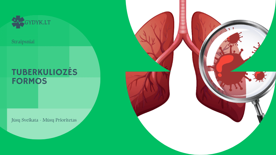 Tuberkuliozės formos