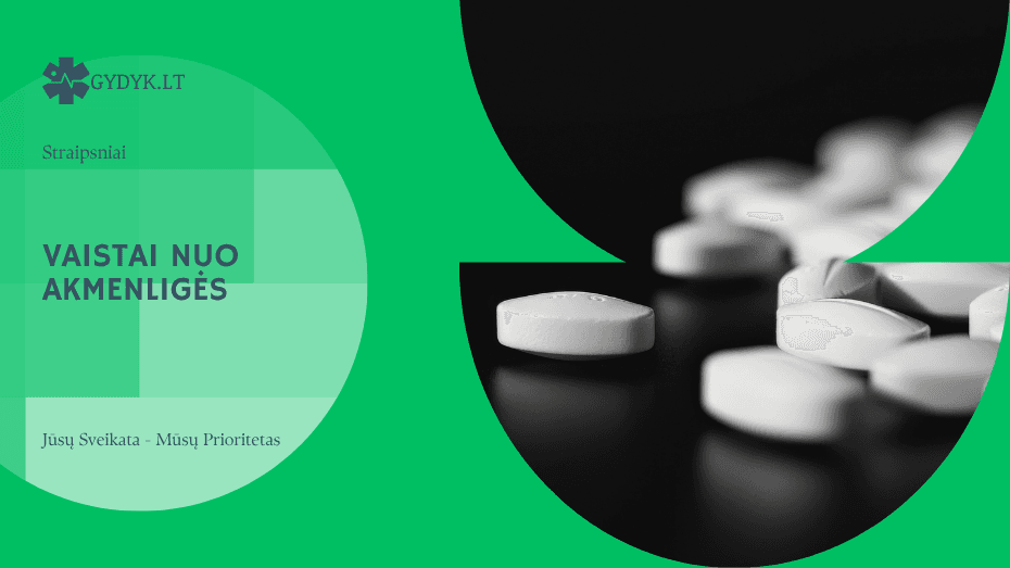 Vaistai nuo akmenligės: kada jie padeda ir ką svarbu žinoti?