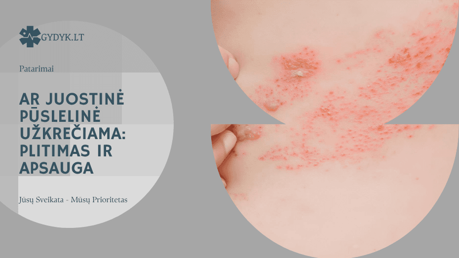 Ar juostinė pūslelinė užkrečiama: plitimas ir apsauga