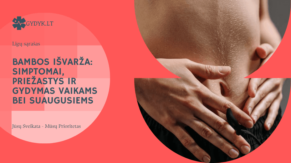 Bambos išvarža: simptomai, priežastys ir gydymas vaikams bei suaugusiems