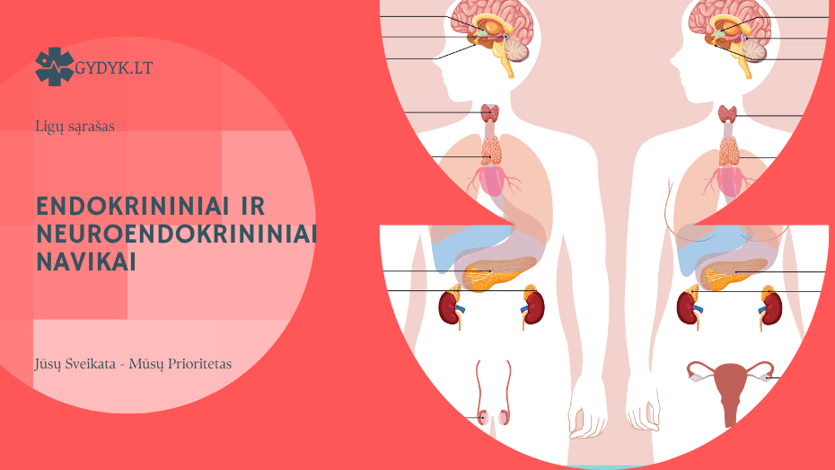 Endokrininiai ir neuroendokrininiai navikai: tipai ir gydymas