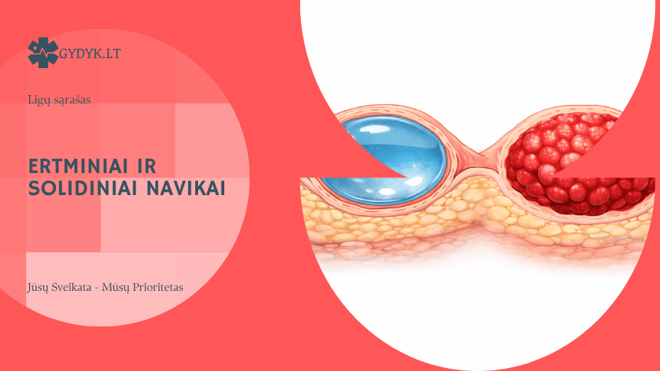 Ertminiai ir solidiniai navikai: kas tai ir kuo skiriasi