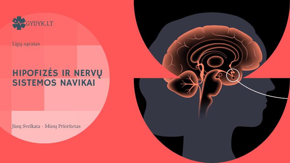 Hipofizės ir nervų sistemos navikai: simptomai ir gydymas