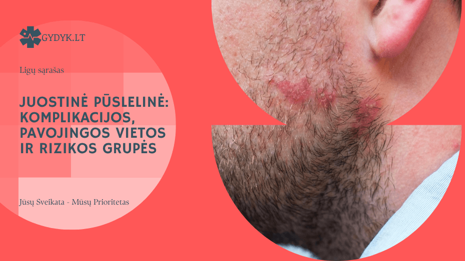 Juostinė pūslelinė: komplikacijos, pavojingos vietos ir rizikos grupės