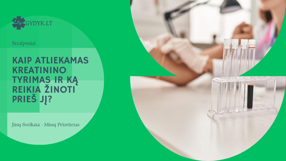 Kaip atliekamas kreatinino tyrimas ir ką reikia žinoti prieš jį?