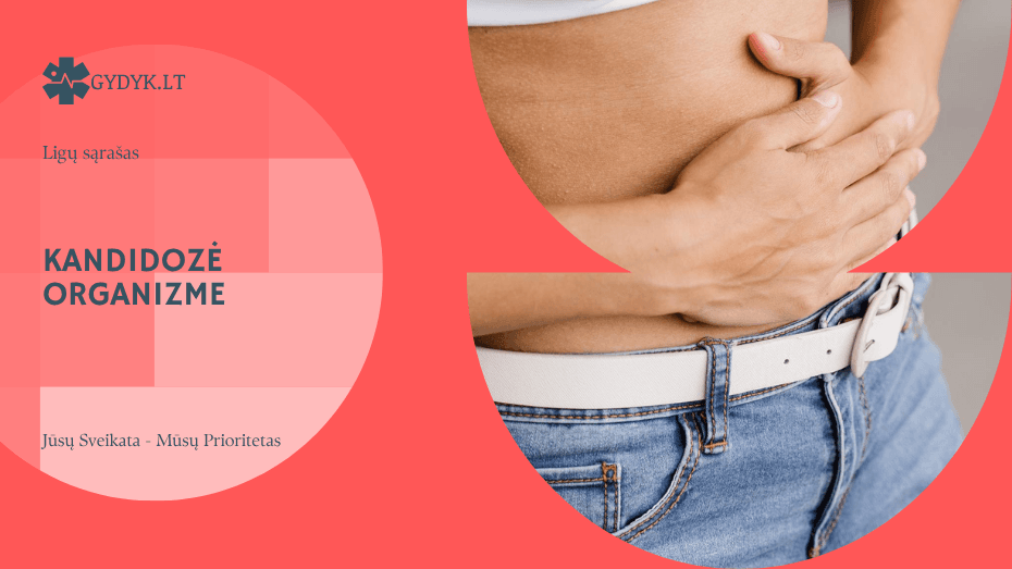 Kandidozė organizme: žarnyno ir kitos formos