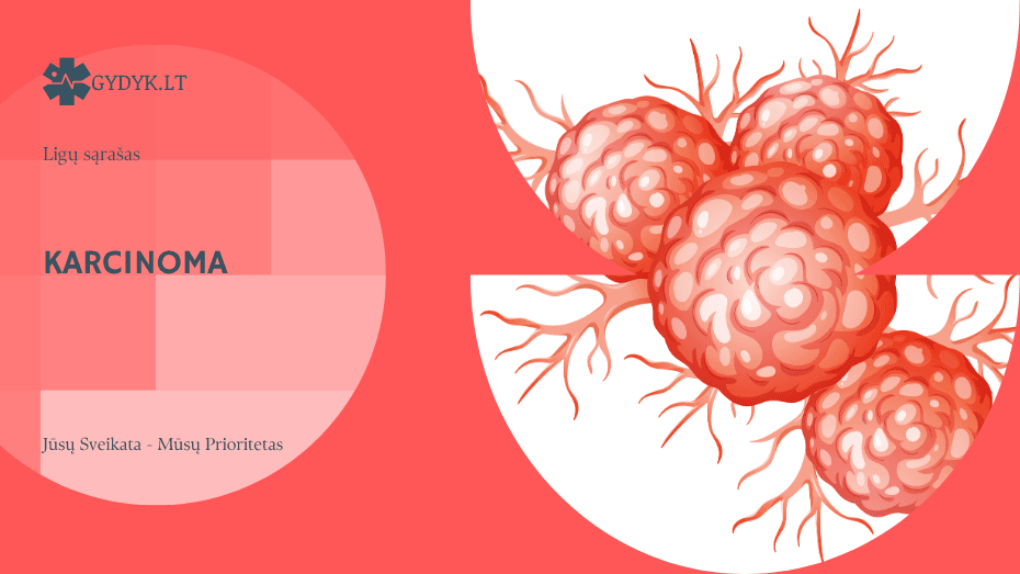 Karcinoma: kas tai, simptomai, kaip atrodo ir pagrindiniai tipai