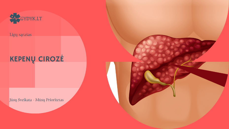 Kepenų cirozė: stadijos, progresavimas ir paskutinė ligos fazė