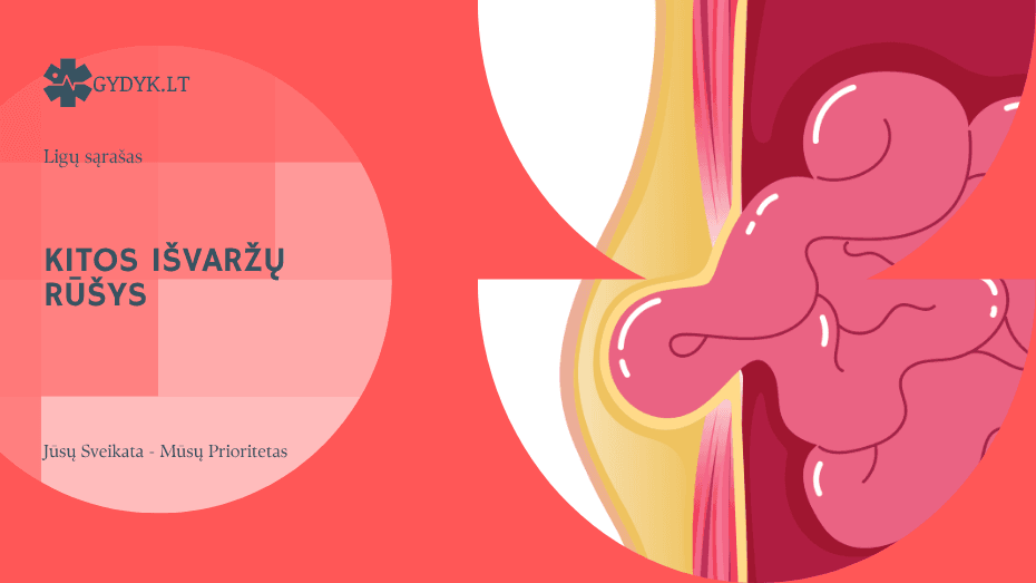 Kitos išvaržų rūšys: riešo, sėklidžių ir retos formos