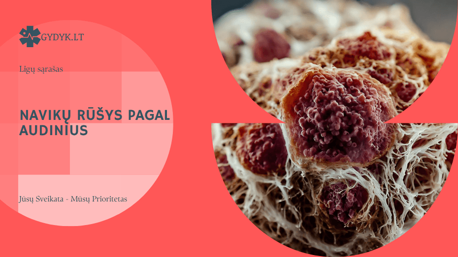 Navikų rūšys pagal audinius: epitelio, jungiamojo, raumeninio ir riebalinio audinio navikai