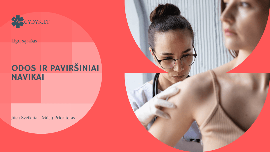 Odos ir paviršiniai navikai: dantenų, odos ir gleivinės navikai