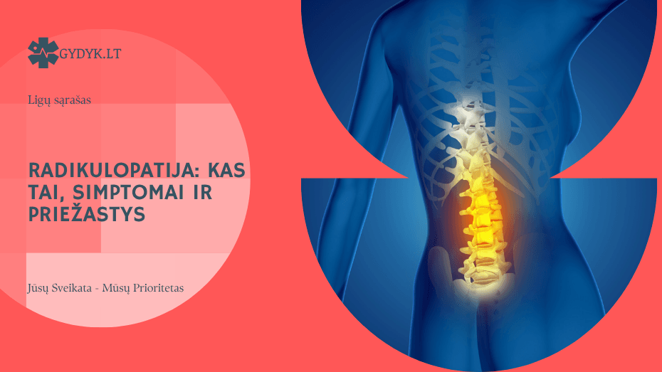 Radikulopatija: kas tai, simptomai ir priežastys