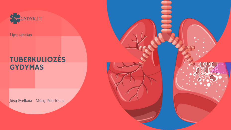 Tuberkuliozės gydymas: ar išgydoma, mityba ir gyvenimas sergant