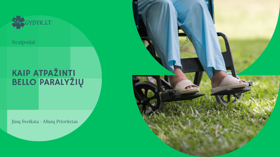 Kaip atpažinti Bello paralyžių ir kada reikėtų kreiptis į gydytoją?