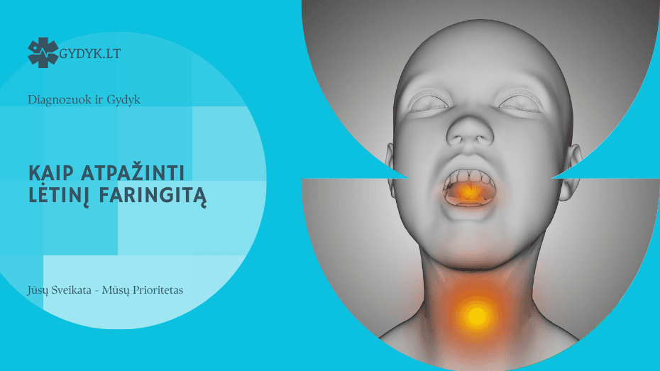 Kaip atpažinti lėtinį faringitą: pagrindiniai požymiai