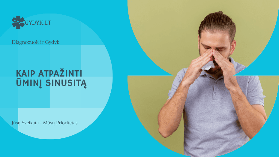 Kaip atpažinti ūminį sinusitą ir kada kreiptis į gydytoją