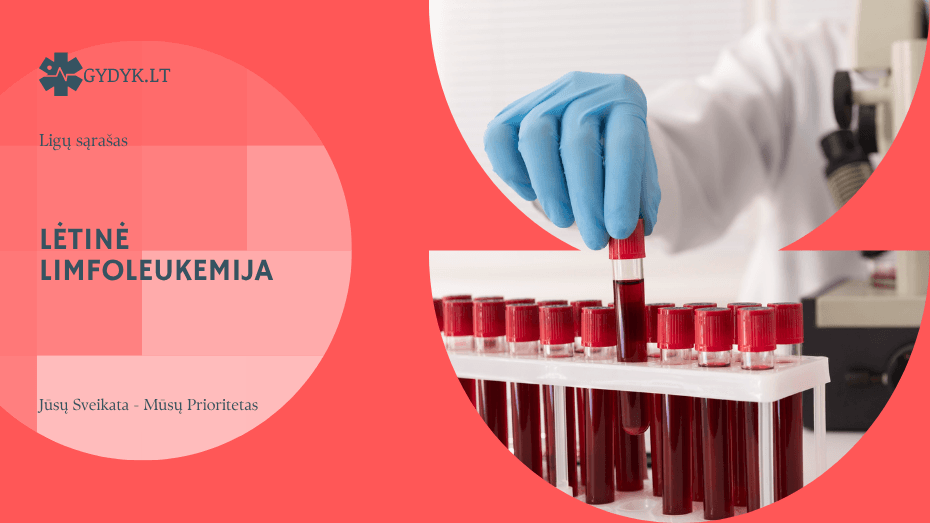 Lėtinė limfoleukemija: gyvenimo trukmė, eiga ir kasdienis gyvenimas