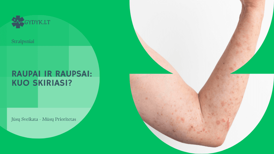 Raupai ir raupsai: kuo skiriasi?