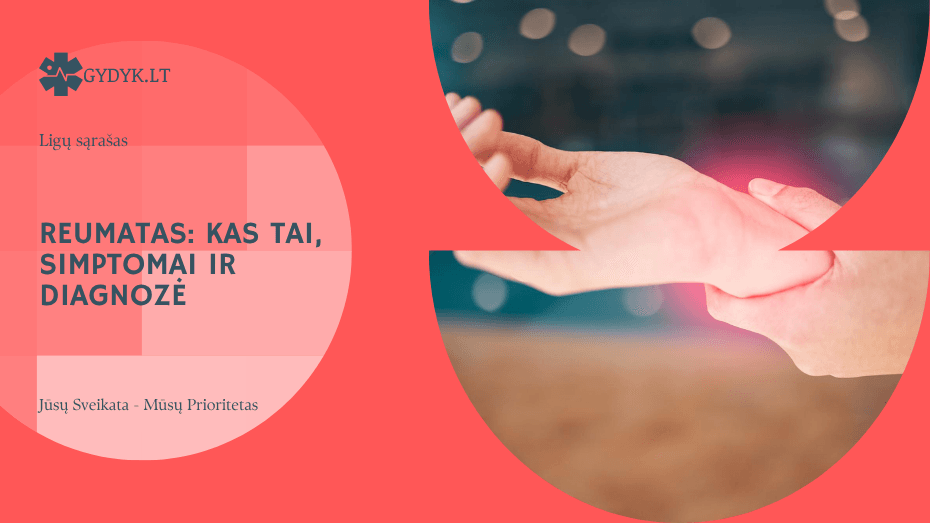 Reumatas: kas tai, simptomai ir diagnozė